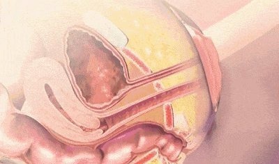 小宝宝|分娩痛得死去活来时宝宝在干嘛?暖哭!你真的不是一个人在战斗!