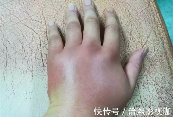 养肝护肝|长寿密码就在手上！五脏六腑历历在“手”，男左女右，秘密都在这