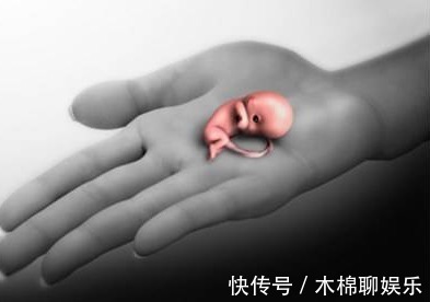 医生|结婚5年怀上宝宝,30周突然胎停,医生坦言因为馋嘴