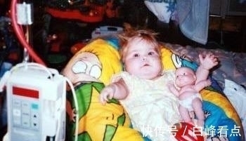 希洛|现实美人鱼女孩:没有双腿长了“人鱼尾”,却从未停止摇摆尾巴