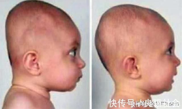 圆头|“妈求求你,别给我睡扁头了”扁头有多毁娃?3张对比图告诉你