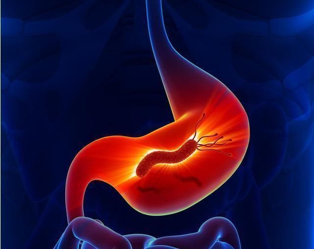 卷心菜|胃不好的人放心，幽门螺杆菌其实不难除，只是需要注意3点