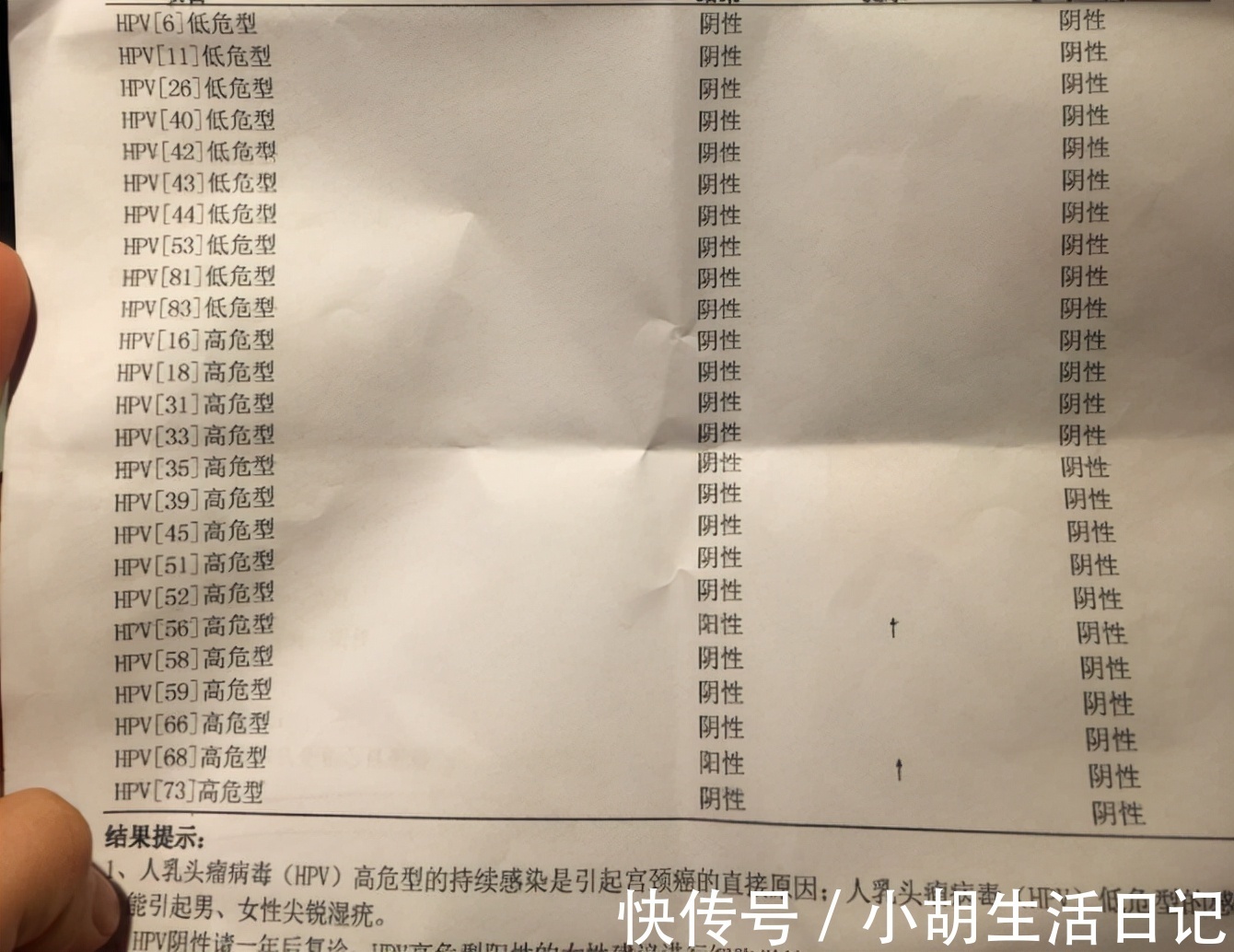 HPV感染|女童喉咙疼痛长“菜花”，一家三口都查出HPV感染，医生：这坏习惯很多人都有