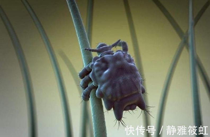 异常|男人若有2个“异常”,可能是被“阴虱虫”看上了,早看早受益!