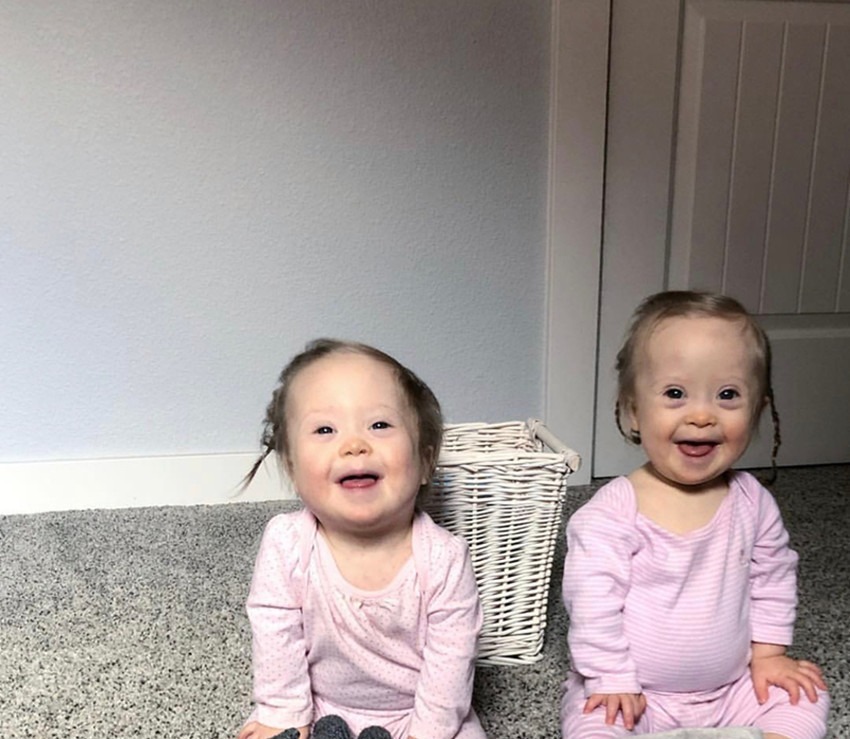 病症|产妇生下唐氏双胞胎姐妹,并没有放弃,网友唐宝都有一张国际脸