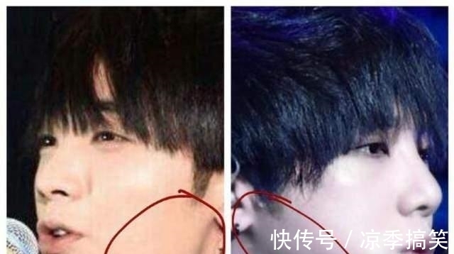 張檬|又是饅頭臉！婁藝瀟張檬孫菲菲，被玻尿酸害了的，還不止這些