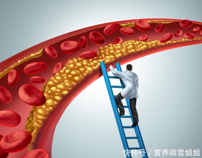 异常|血脂高的人,3类东西,少往嘴里“塞”,坚持6件事,血脂降得快