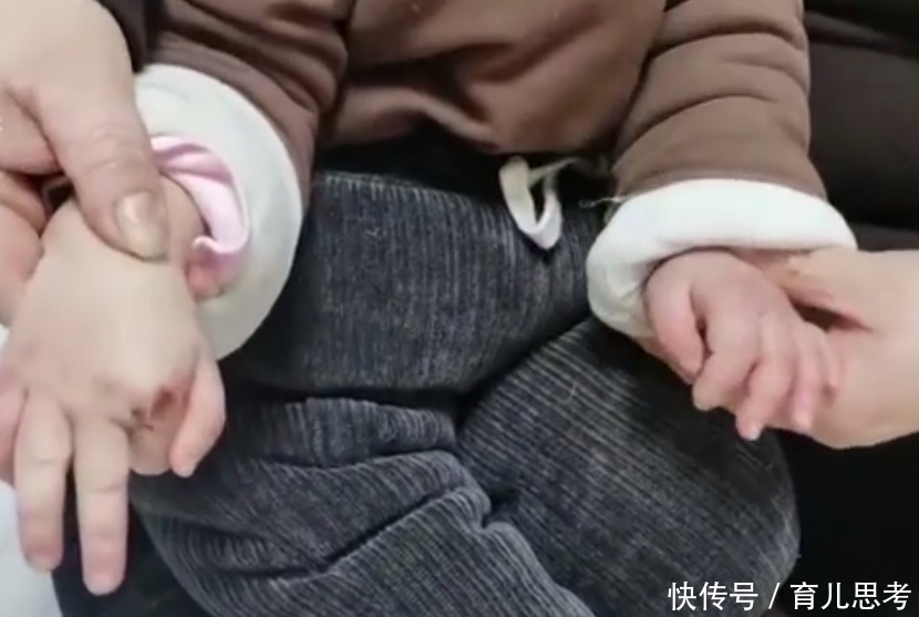 痛觉|三岁女童不会流汗,没有痛觉,并非“超人”,全靠空调保命