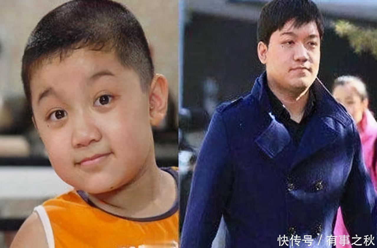 小时候|为什么有些孩子小时候漂亮,长大却长“残”了,两大因素不可忽略