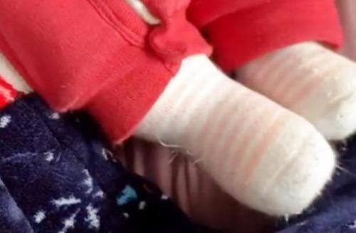 宝妈|宝妈下班回家,发现女儿的脚“胖了”,帮孩子脱掉袜子后笑出声