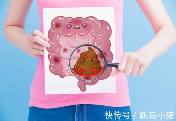 異常|醫生提醒：排便若有四個異常，越早做腸鏡越好