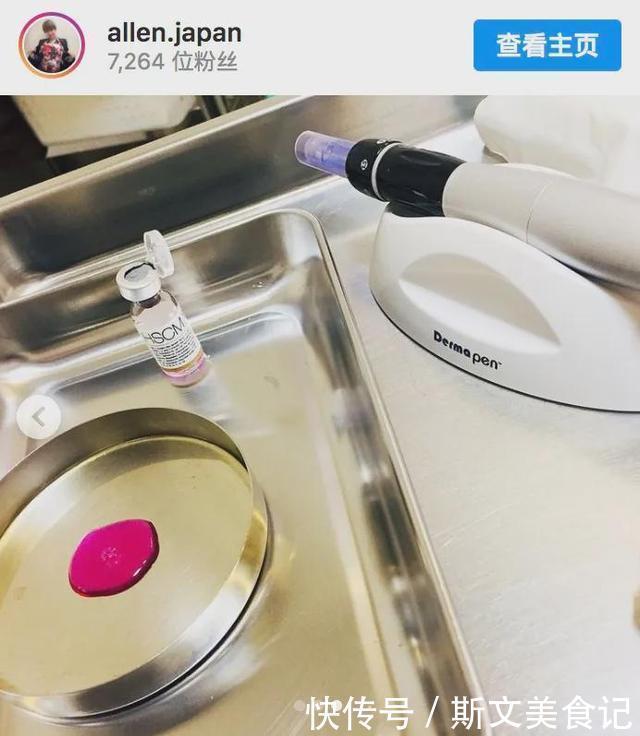 艾伦|日本一帅气小伙花1亿做全身整容，最后终于整成了“悲伤蛙”