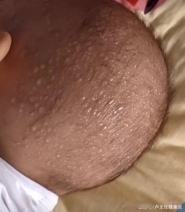 小水|3种食物吃一次10天不消化，很多父母不知道，医生：无知太坑娃