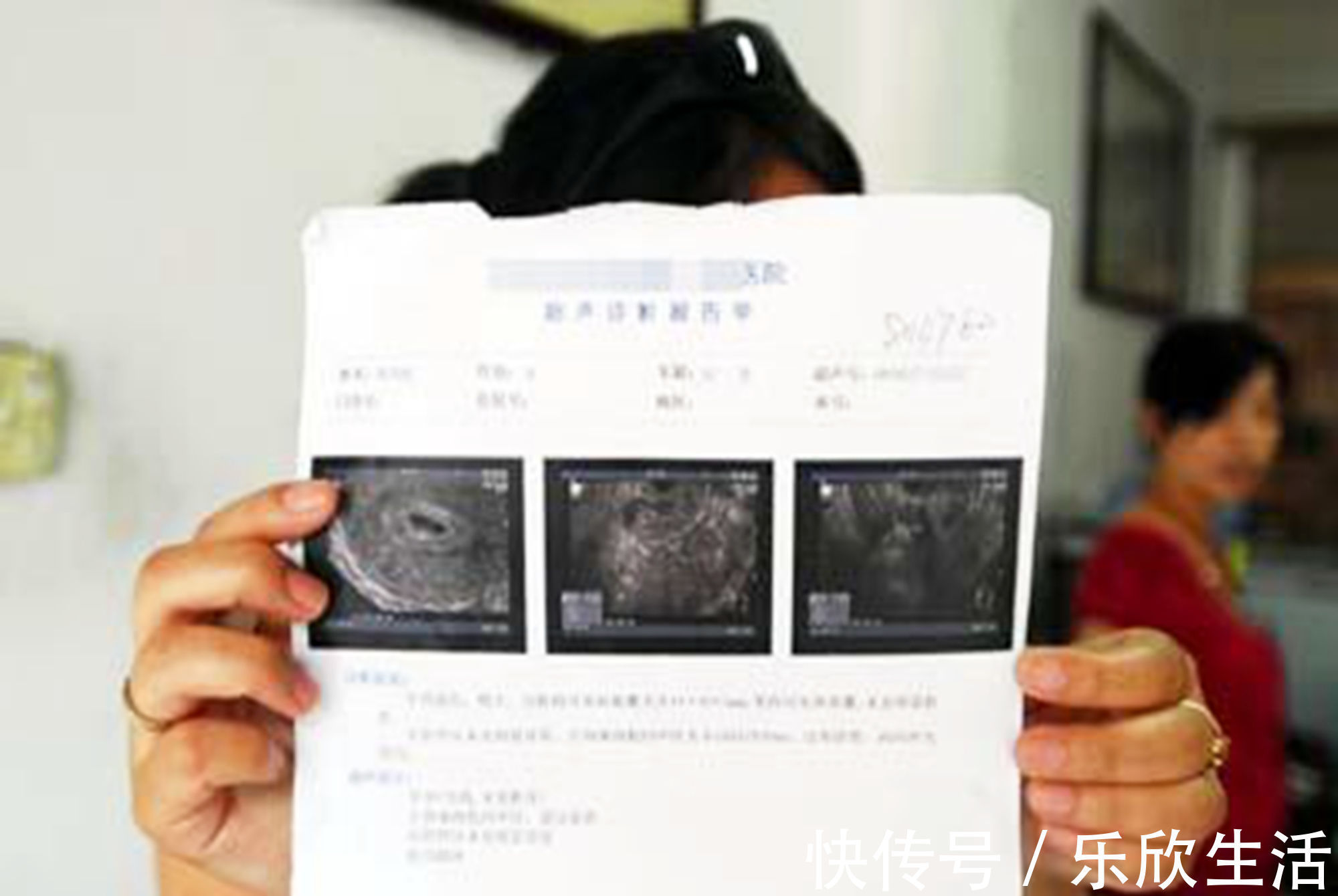 b超|孕早期B超单上的四个指标，暗含了胎儿的“小秘密”，你看得懂吗