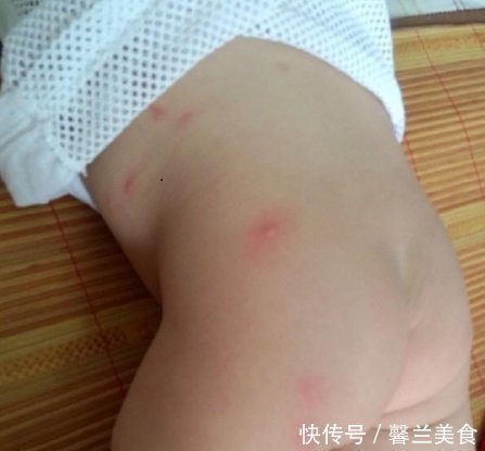 异位性皮炎|床铺螨虫多,家里孩子常过敏,教你一个土办法,螨虫连根拔起