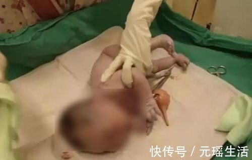 护士|新生儿出生后的10分钟,在护士手里经历了什么?很多妈妈都不知道