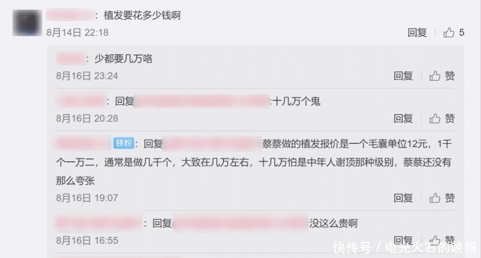 蔡萝莉发际线上移，为了美丽植发11个小时，一个毛囊报价12元