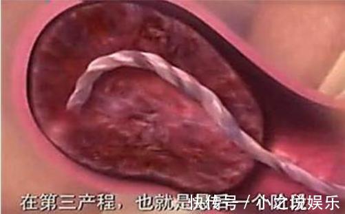 用力过猛|胎儿那么大,如何从那么小的产道出来看完知道女人有多伟大!