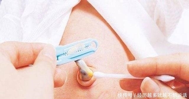 脐带|肚脐眼能不能抠?喜欢抠肚脐眼的孩子,你们知道后果会是怎样吗?