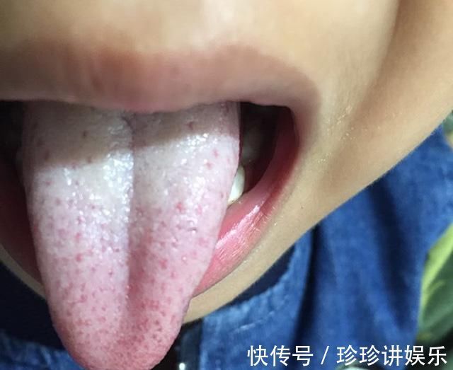 皮皮|孩子积食，身体会发出五个信号，中招的父母快停手，别再喂娃多吃