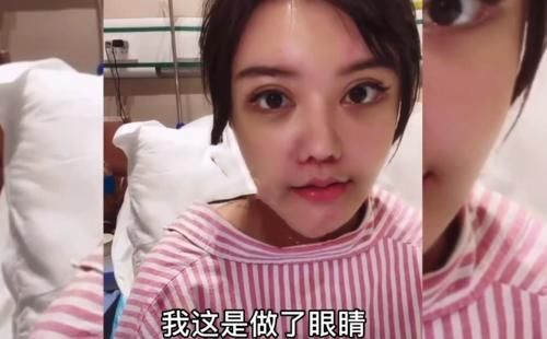 面部|22岁韩安冉面部下垂，多次修复鼻子再无法动刀，越整越像“僵尸脸”