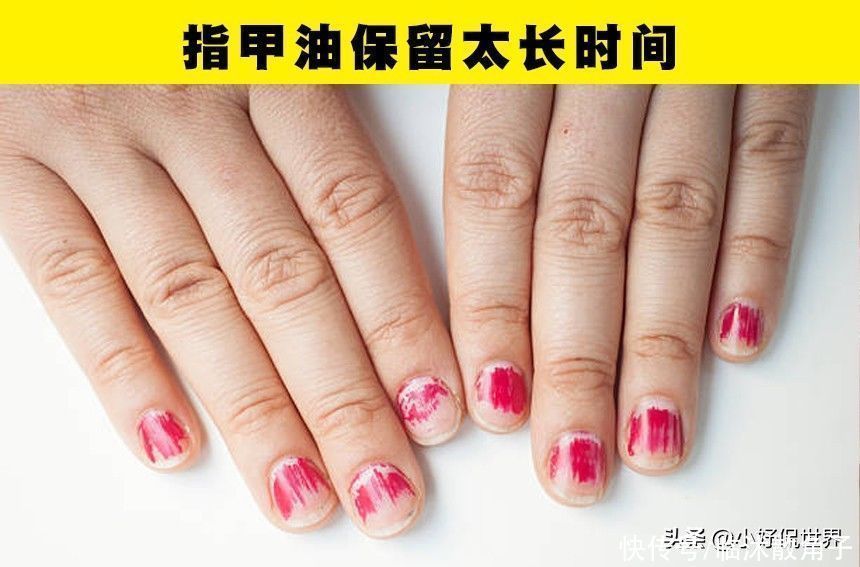指甲油|在日常生活中,可能会对指甲产生破坏的7种习惯