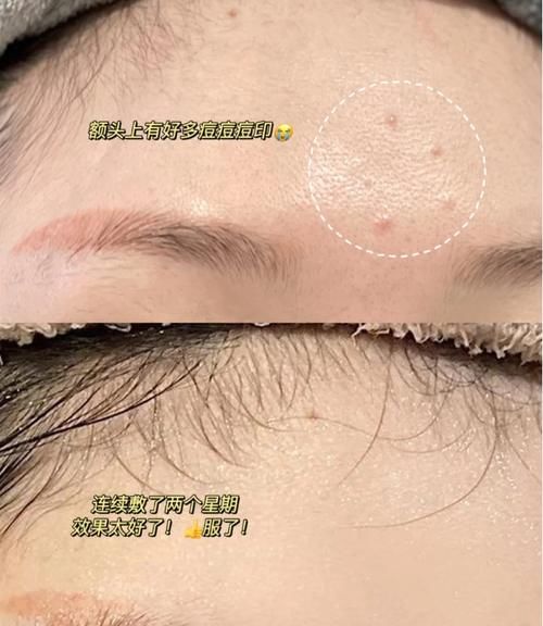 常敷面膜除了日常补水，还有这几个好处！别不知道