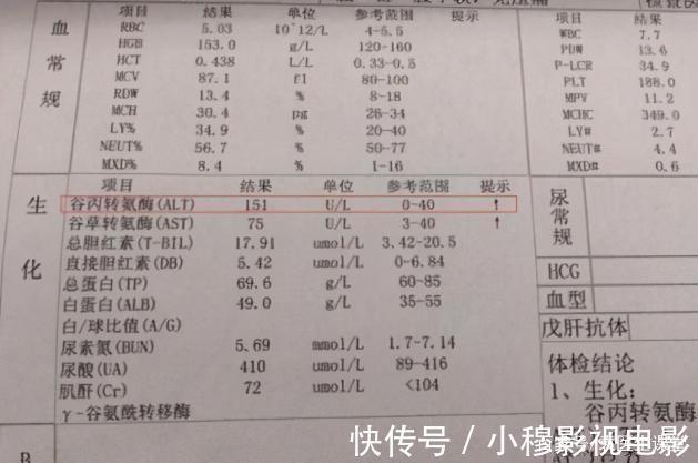肝功|67岁男子,从肝硬化转为肝功正常,常吃一物,肝脏慢慢柔软