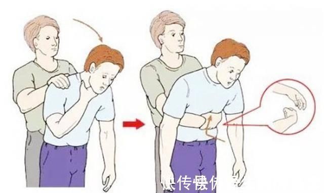 卡住|4岁宝宝鱼刺卡喉,医生称赞:父母的两个果断处理,救了孩子
