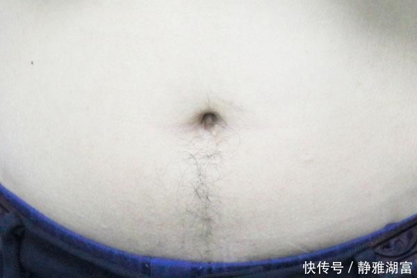 肠炎|用生姜贴在肚脐上,不管男女,对身体的好处都极大,许多人不了解