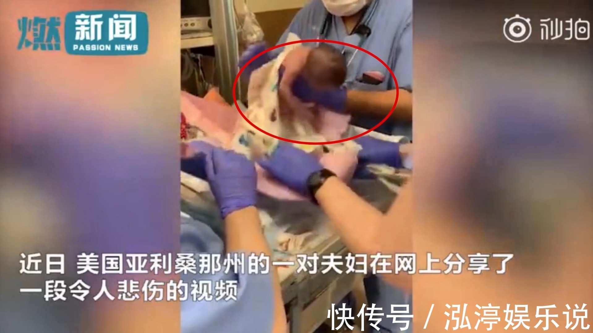 医生|气愤!医生重摔早产女婴还若无其事 爸妈6周后才知道宝宝脑出血