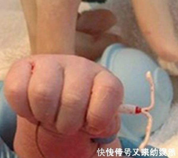 医生|宝宝出生,自带武器,医生凑近一看,大吃一惊