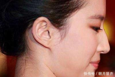 鼻头|公认最丑的4种“鼻型”,每1种都很影响颜值,希望你一个不中