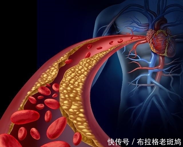血管洗个澡,健康活到老,不妨每天“洗”1次,现在知道还不晚!