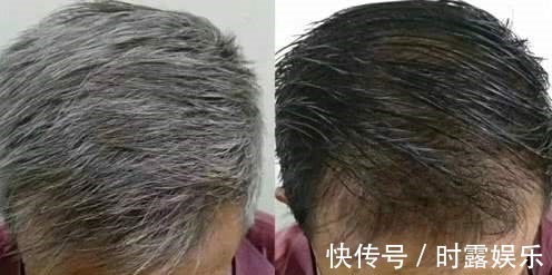 白发|黑发多是“吃”出来的!医生提醒3种食物是白发高手,最好少吃