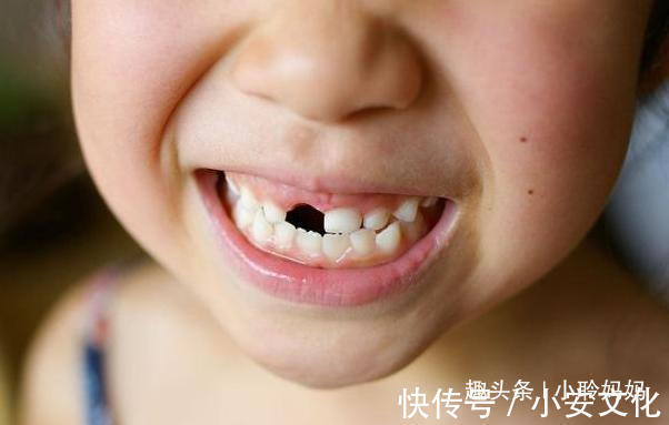 干细胞|孩子乳牙掉了先别扔,关键时候能救命事情可能没你想的那么简单