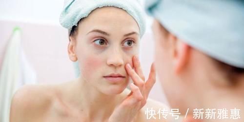 角质层|不会吧不会吧,好多人还不知道自己是敏感肌?怪不得皮肤越来越糟
