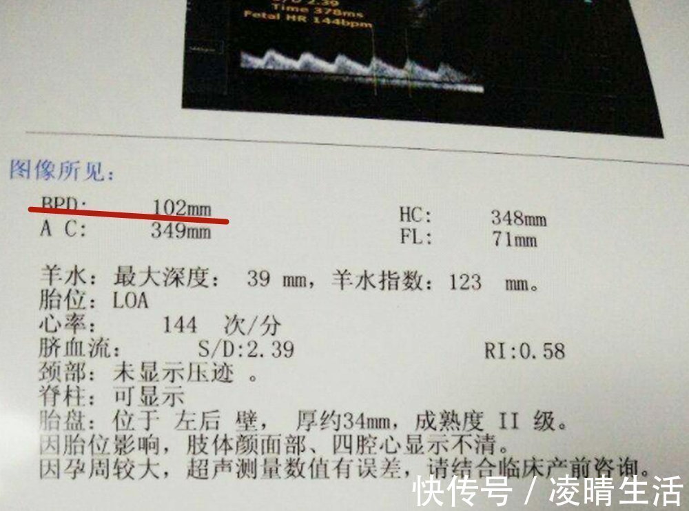 小结|“胎儿头大不能顺产”产前双顶径多大,孕妈才能顺利自然分娩