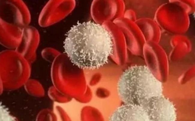 诱发|超市里的3种水果，含有大量的甲醛，诱发白血病，千万别给小孩吃