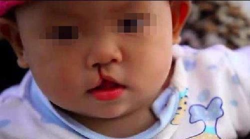 海中|妈妈故意弄丢6岁兔唇女儿,20年后在人海中相遇,如今悔不当初