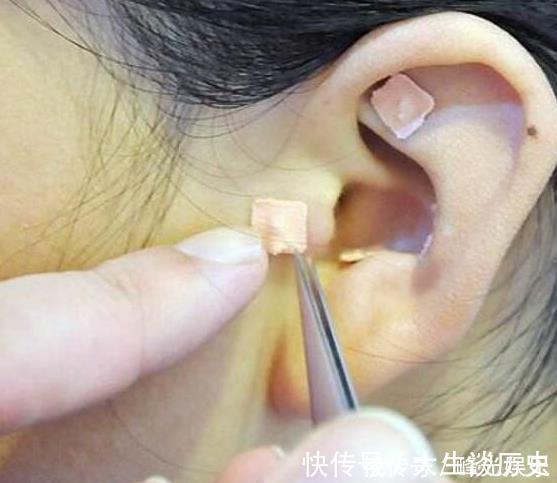 耳朵|失眠不吃药,每天捏一捏耳朵,一觉睡到大天亮