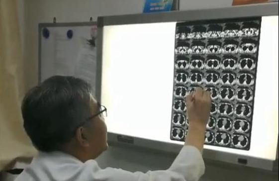 纵隔|32岁年轻妈妈前纵隔发现巨大肿瘤，手术风险高，要不要做