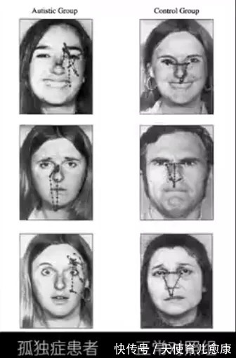 孩子|敏感还是迟钝？自闭症儿童的“感觉异常”到底是怎么回事？