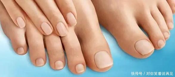 不错|如果你的脚上没有这些“表现”,恭喜,你的肾脏保养的还不错