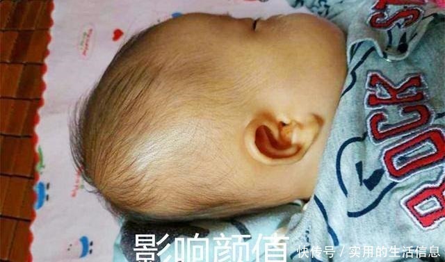 小碰|“妈妈别给我睡扁头”，为何老一辈坚持给娃睡扁头，真的很毁颜值！