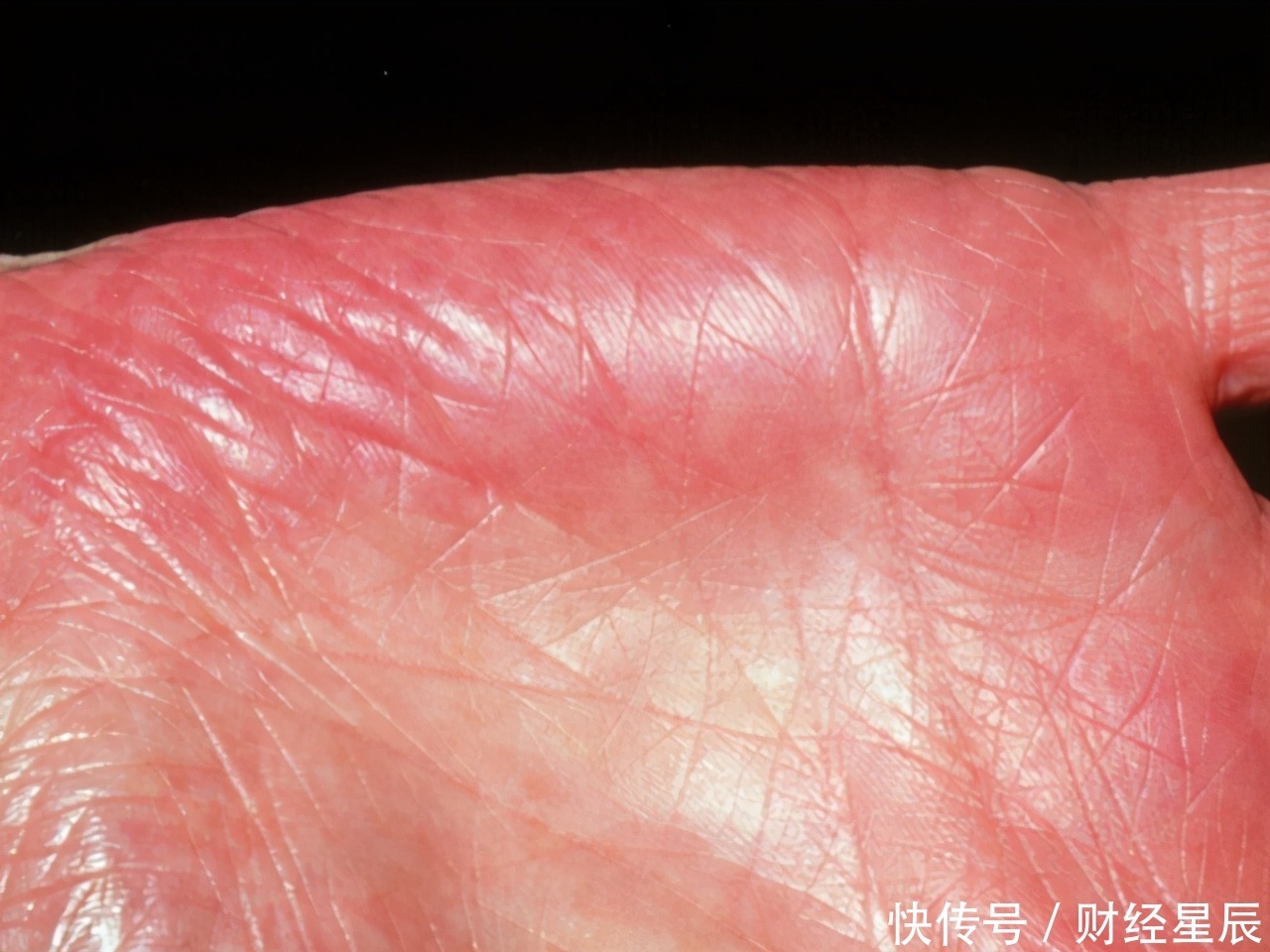 慢慢|强肝“高手”已找到了,并非蒲公英,适量补充,肝慢慢变强