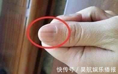 白血病|身体如果出现3种现象，说明癌症可能找上你了，尽早检查