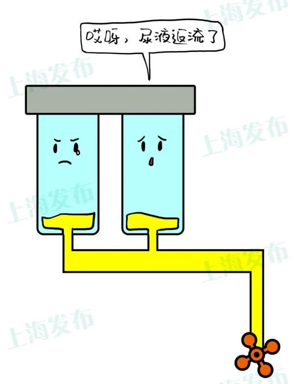 慢性肾炎|【医聊】憋尿就是把肾泡在脏水里，怎样护肾养肾？