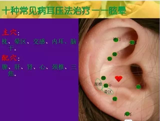  交感|十种常见病耳穴疗法