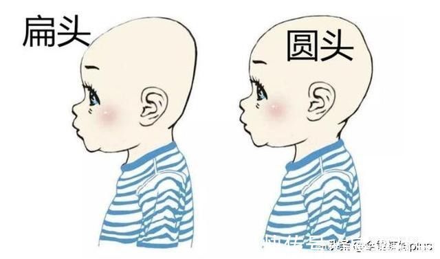圆头|“妈求求你,别给我睡扁头了”扁头有多毁娃?3张对比图告诉你